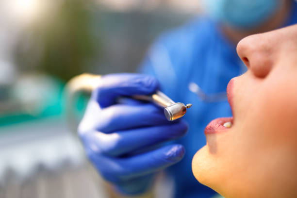 Best Teeth Whitening  in Wilson, OK